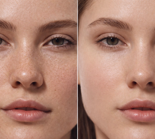 Ácido Láctico 10% + HA